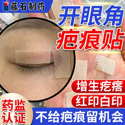 医用级割双眼皮术后疤痕修复贴