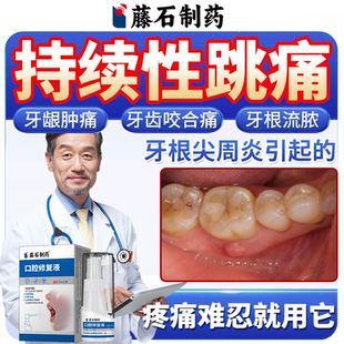 牙根发炎肿痛疼痛神经性根尖周炎止痛消炎专用牙龈喷剂药房同售VQ