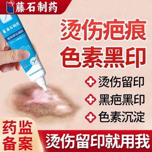 烫伤烧伤疤痕修复除疤膏去黑印色素沉淀油烫伤淡化疤印去伤疤WQ