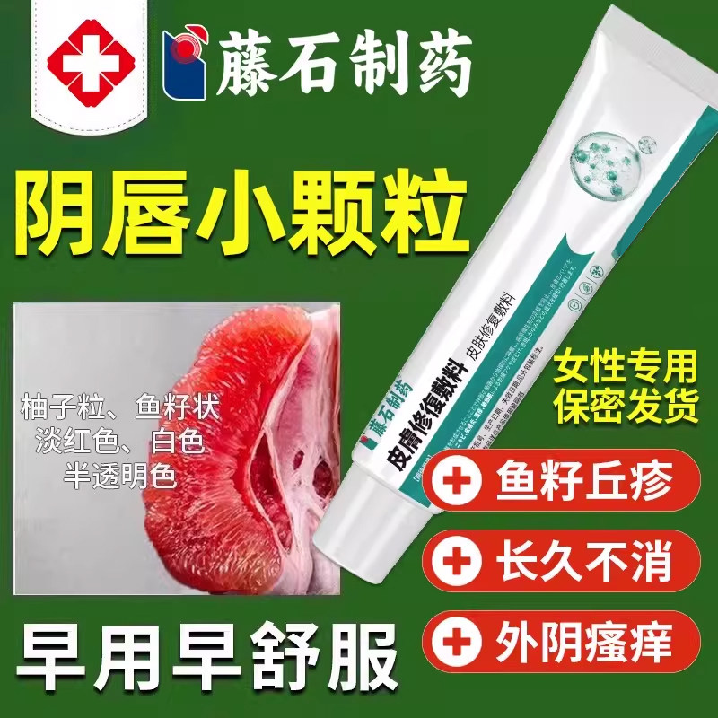 女性假性尖锐湿疣去除内阴外阴瘙痒去止痒根妇科乳软膏凝胶专用WQ
