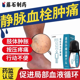 藤石制药下肢小腿深浅静脉去血栓曲张冷敷凝胶预防肿痛僵硬发黑YZ