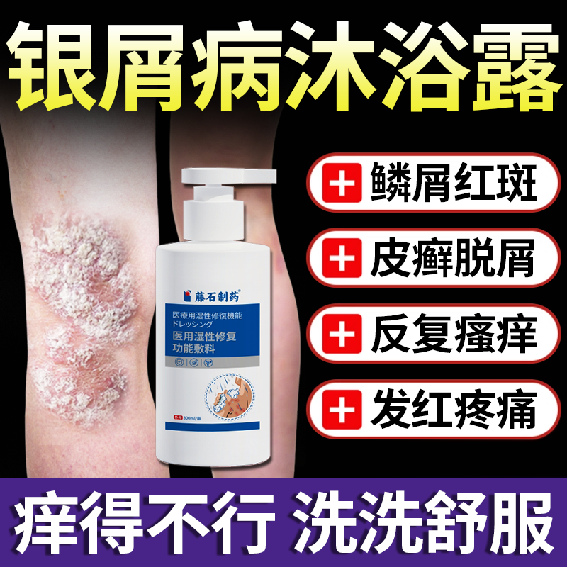 顽固牛皮癣藓银屑病专用体癣红斑鳞屑沐浴露止痒可搭配膏泡澡用TU