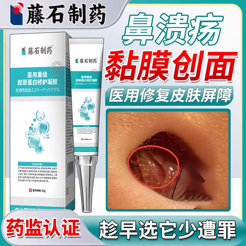 鼻中隔鼻腔溃疡上火鼻子生疮结痂鼻黏膜糜烂干燥性鼻炎修凝胶复HT