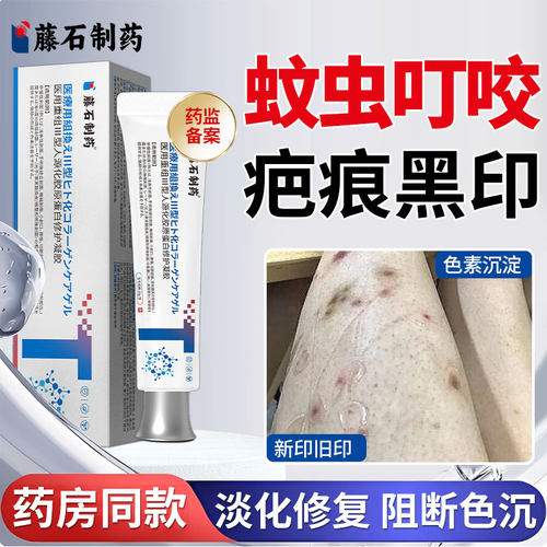 皮肤黑色素沉淀去除医用型