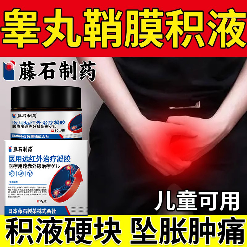 睾丸鞘膜积液--睾丸肿胀坠痛专用