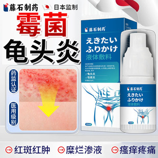霉菌性龟头炎症男性真菌感染专用喷剂珍珠丘疹包皮炎药房同售膏DS