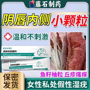 女性外阴假性尖锐湿疣去除专用软膏下面阴道口长小疙瘩私处瘙痒WQ