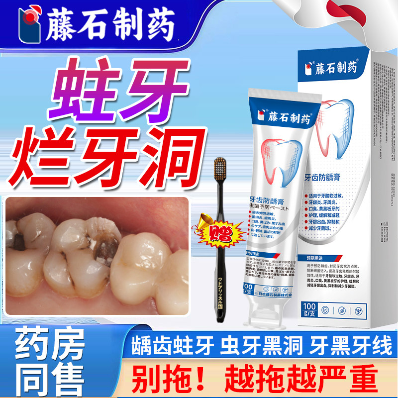 儿童蛀牙牙洞清理牙虫的牙齿防龋凝胶去黑线黑渍牙窝沟药房同售DS,医疗器械,牙齿防龋/脱敏类,淘宝优惠券,粉丝福利购,淘宝优惠卷