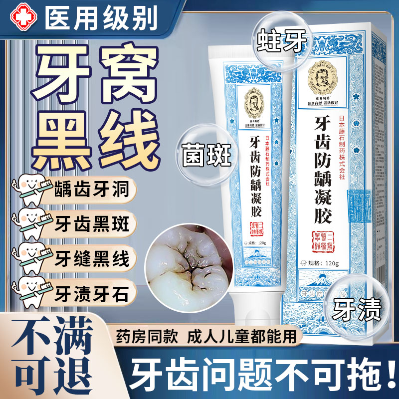 牙菌斑牙膏牙齿牙黑线去除补牙缝蛀牙祛除龋齿专用缝隙黑牙黑斑CB