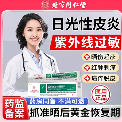 日光性皮炎紫外线过敏晒伤膏