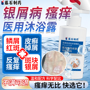 银屑病牛皮藓专用沐浴露皮肤红斑鳞屑真菌性体癣止痒药房同售膏VQ