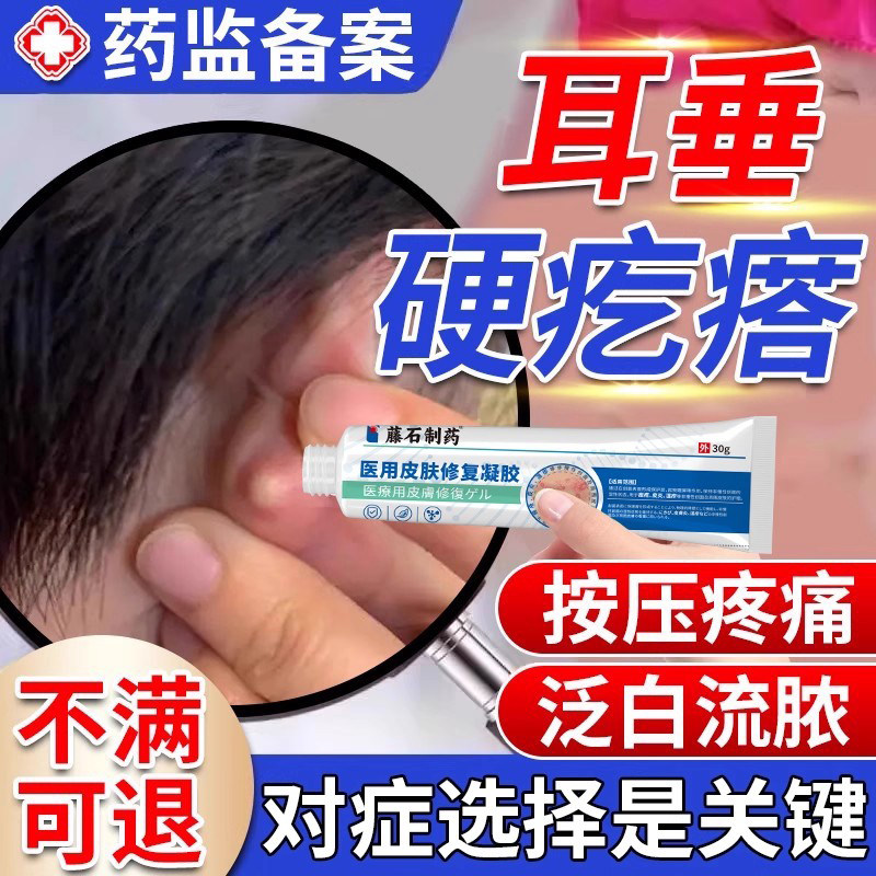 【耳垂硬疙瘩】耳垂长痘疼痛专用