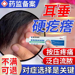 耳垂耳朵后面长疙瘩粉瘤皮脂腺囊肿疖肿硬块拔毒火疖子敷料贴膏VQ