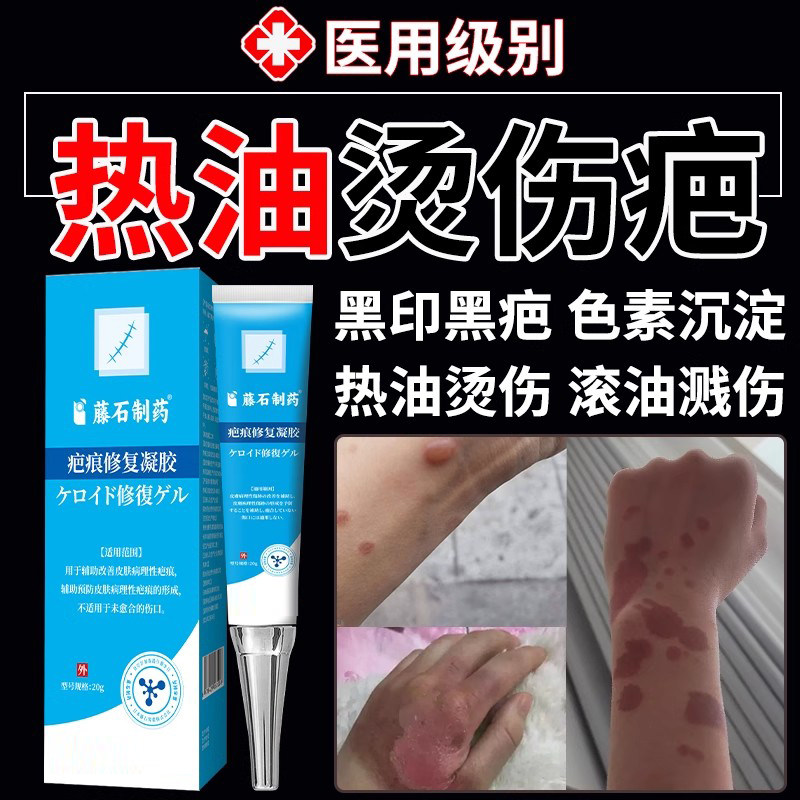 被油热油烫伤去疤膏疤痕修复去黑色素黑印色素沉淀祛除疤膏凝胶VQ