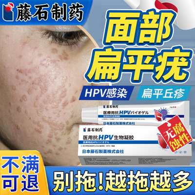 【日本监制】面部扁平疣专用软膏
