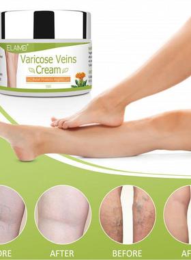 Stretch the creamed veins and the legs of the earthworms and