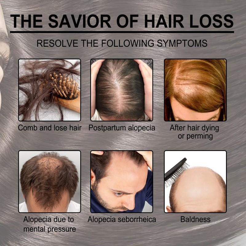 Rosemarys hair oil. Its good to keep her hair clean.