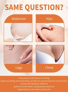 Pre-natal and post-natal care of pregnant women with corruga