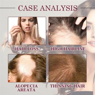 The onions are so thick and oily and the hair is so tender a