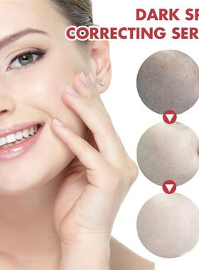 Skin-skinned, black-skinned, old-age sprouts of lightly lumi