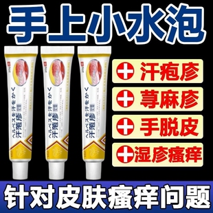 手上起小水泡药专用疱汗状疹专用软膏脱皮止痒真汉状菌感染手气膏
