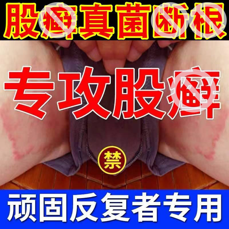 苗药抑菌膏皮肤过敏外阴大腿内侧