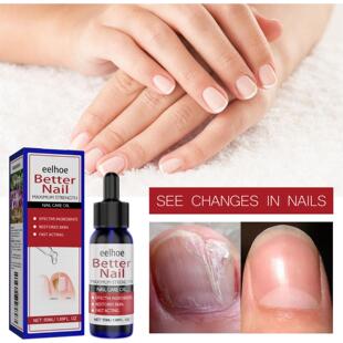 EELHOE Nail Care Solution - Nail Nourishment and Moisturizin