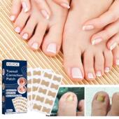 Toenail Correction Stickers EELHOE Ingrown Correcti
