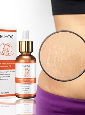 EELHOE Scar Repair Essential Oil - Pregnancy Skin Care and S