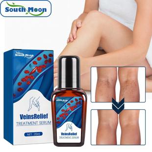 South Moon Vein Repair Liquid relieves the pain of varicose