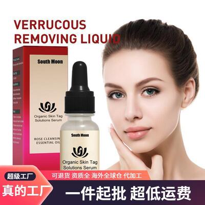 South Moon Mole Removal Liquid Deep Cleansing Skin Tag and M