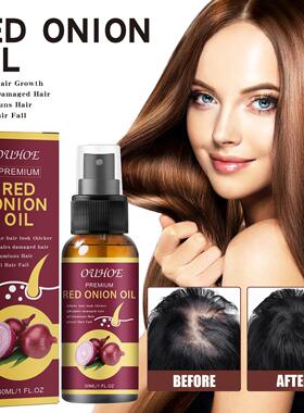 OUHOE Onion Dense Hair Essence - For Fuller, Smoother, Stron
