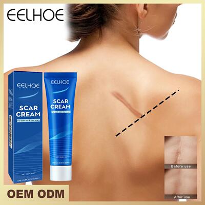 EELHOE Skin Care Cream - Gentle and Nourishing External Body
