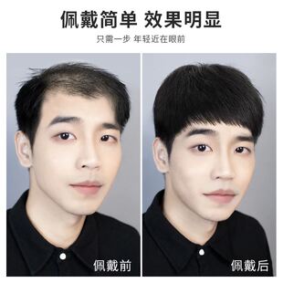 假发男短发真发无痕头顶补发男士 假发片前额隐形全真发轻薄透气