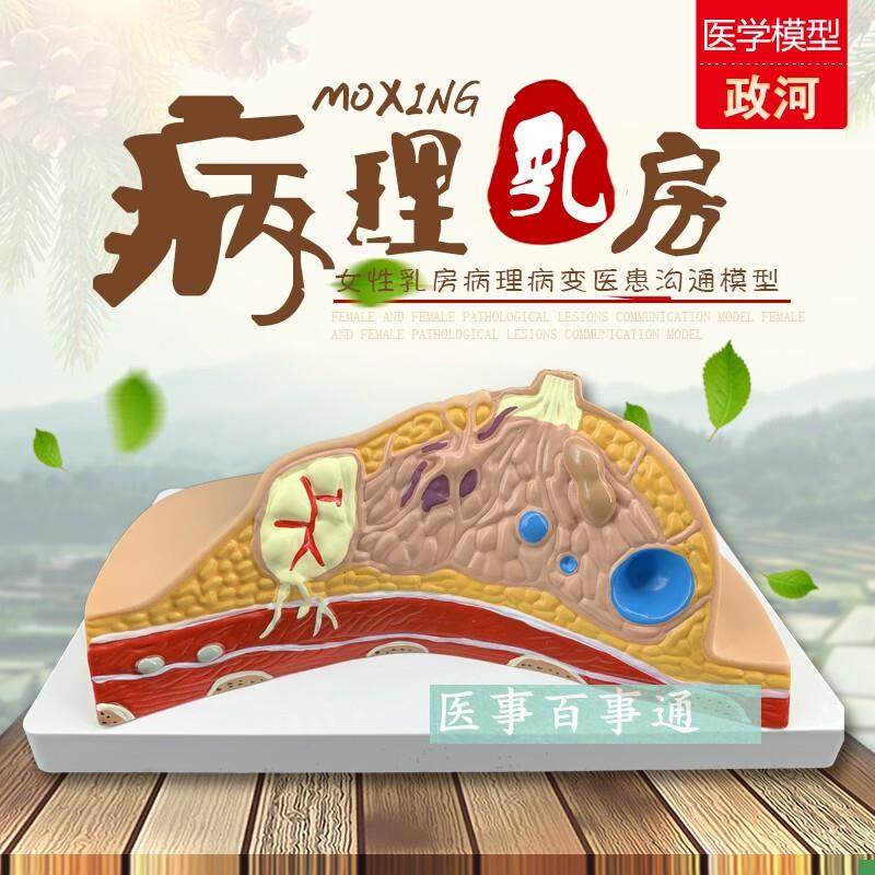 乳房模型解剖催乳培训健康教育生理生I物生殖哺乳期妇女用具器材