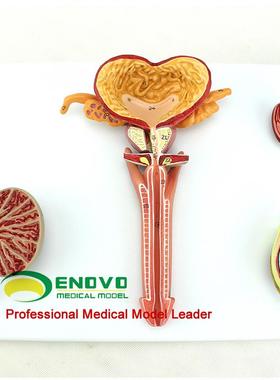 ENOVOd颐诺医学人体男性生殖系统解剖模型男科泌尿内科内外生殖器