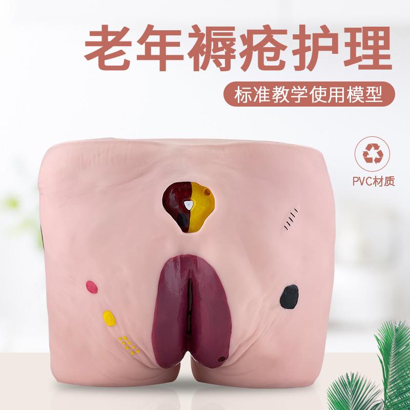 教学模型医院培训模u型高级老年人褥疮压疮护理模型