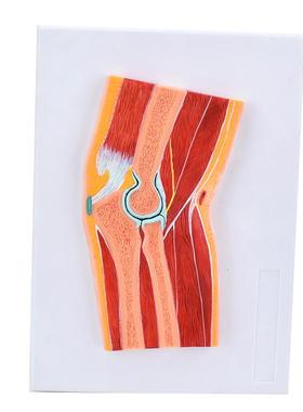 ENOVO颐诺医学解剖肘关节骨骼肌肉模型H肘关节剖面肘关节构造MRI