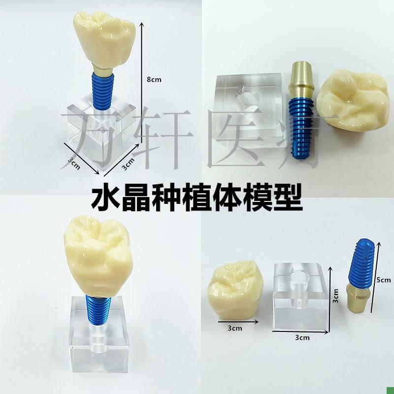 牙科口腔种植体模型水晶种植w体牙模可拆卸口腔教学模型齿科小水