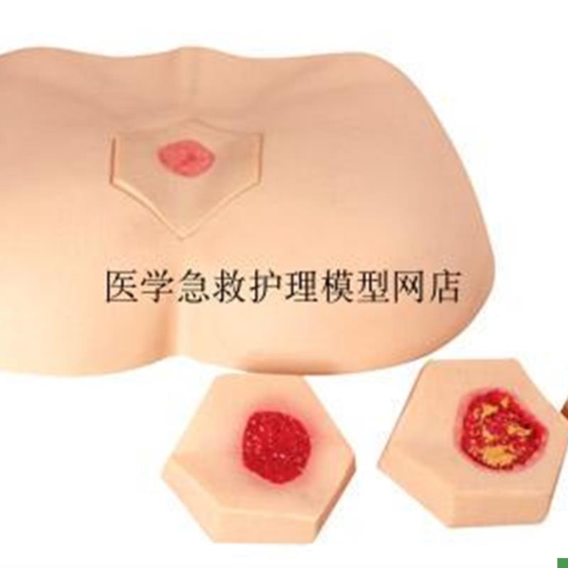 阶段褥疮护理模型护理操作不同阶段四个临S床分期成人臀部