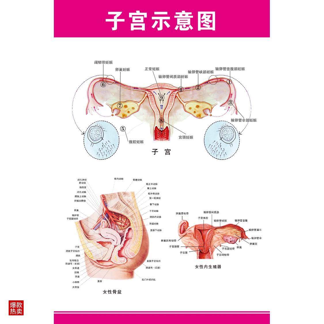 女性生殖器解剖图 医院宣传海报挂图子宫 妇科海报宫颈疾病示意图
