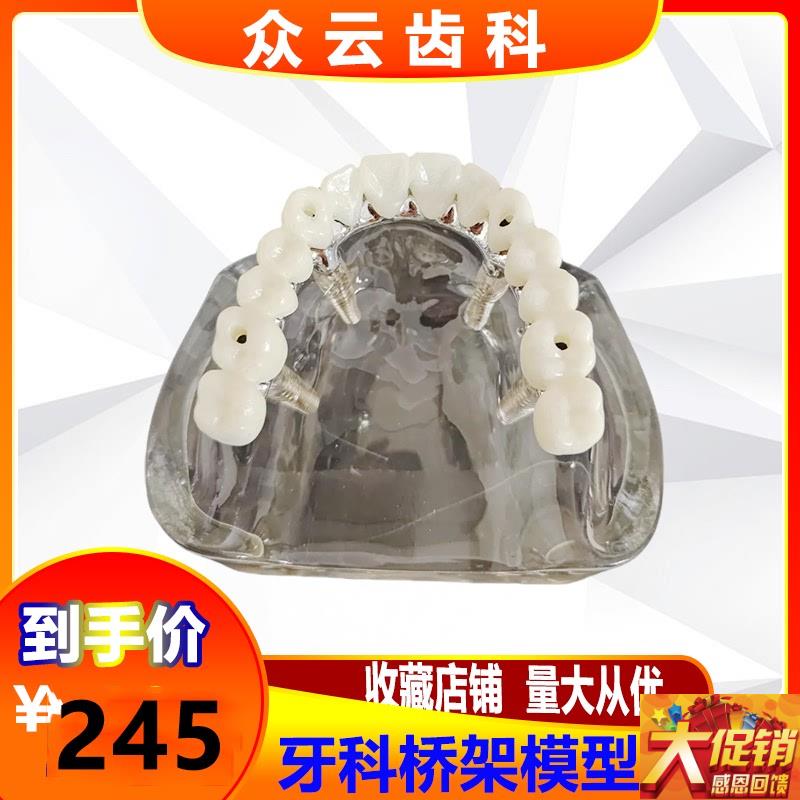 牙科种植体修复模型种植钉球帽A结合半口综合病理种植与无牙颌模