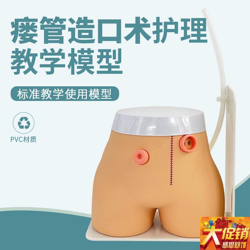 高级瘘管造口术护理模型实验室教学用品基本O护理技能模具回肠造