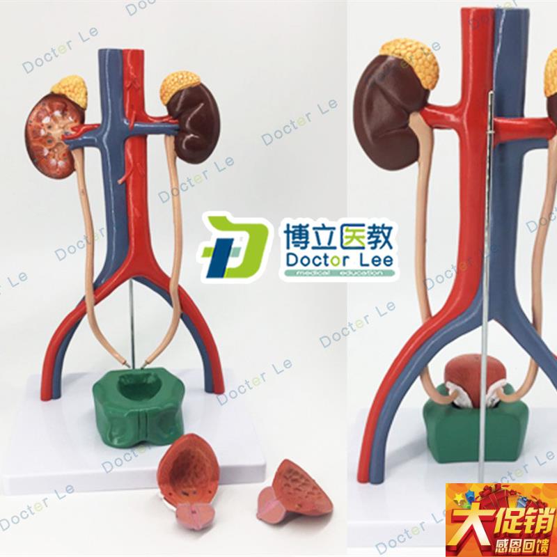 人体泌尿系统模型肾输尿管膀胱尿道解剖模K型医学泌尿科 解剖模型