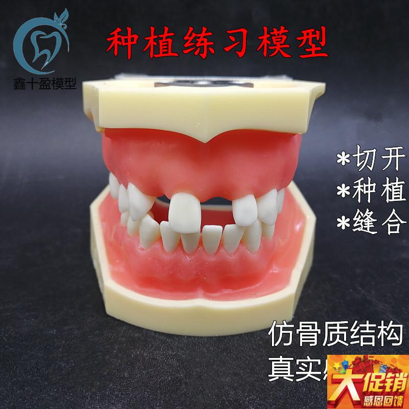 牙科种植上下缺失练习p切开种植缝合仿骨质牙齿模型上颌窦提升术