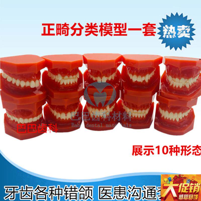 牙科正畸牙齿错颌模型 地包天 A天包地 龅牙正畸分类展示模型一套