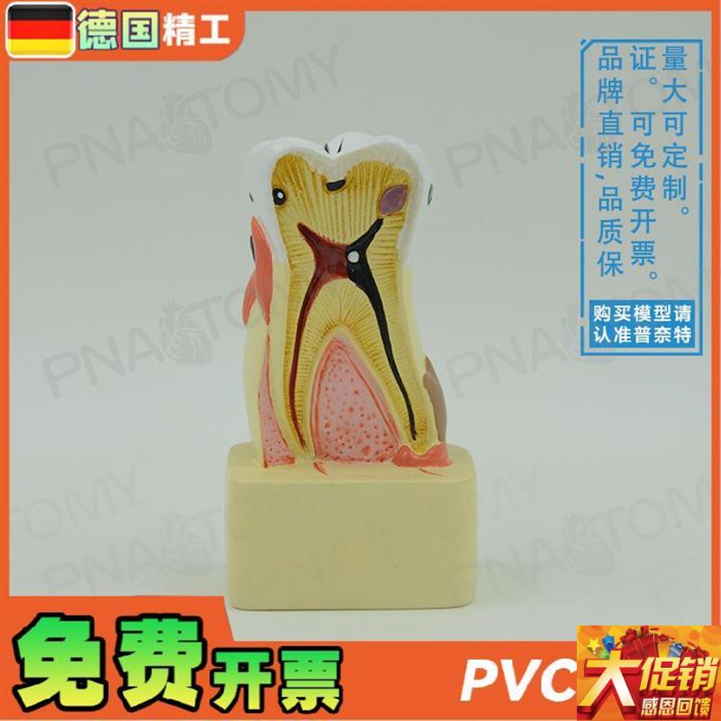 德国】牙齿模g型幼儿园口腔教学玩具牙科 教学口腔科病理医患沟