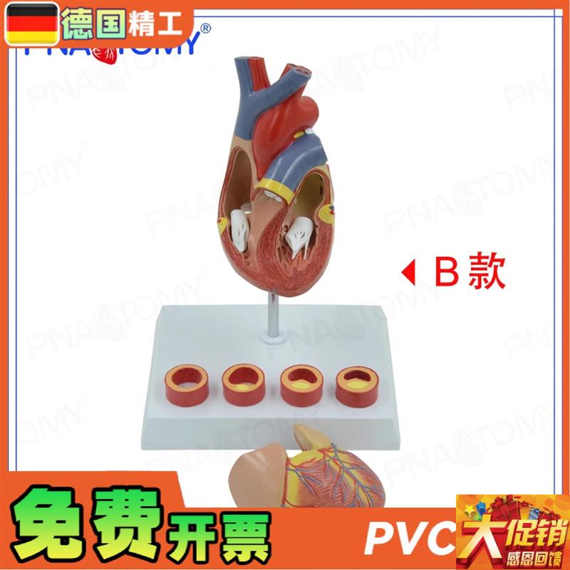 德国】PNdT-0724 心脏模型4阶段血管动脉病理期心脏解剖心血管科