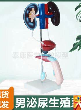 泌尿生殖系统模型 肾脏 输尿管 膀胱 前列腺 子Q宫 内外生殖器睾
