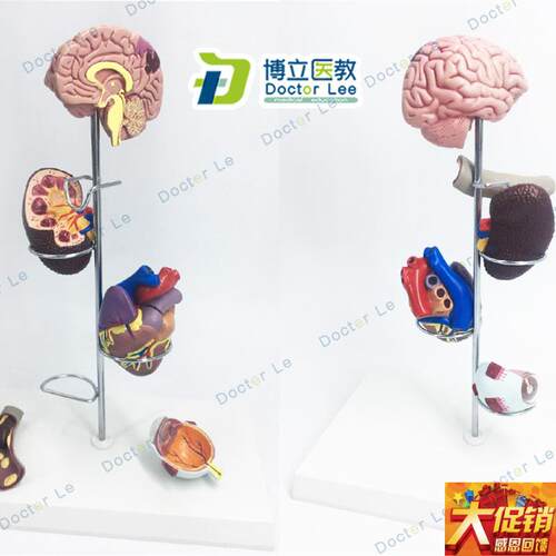 进口人体高 血 压 模型 并发症 心脏模型 肾脏模U型眼睛模型脑模